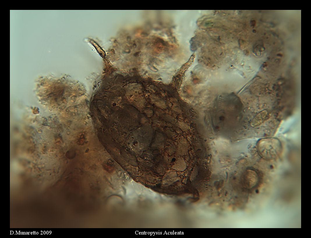 Centropyxis Aculeata...due